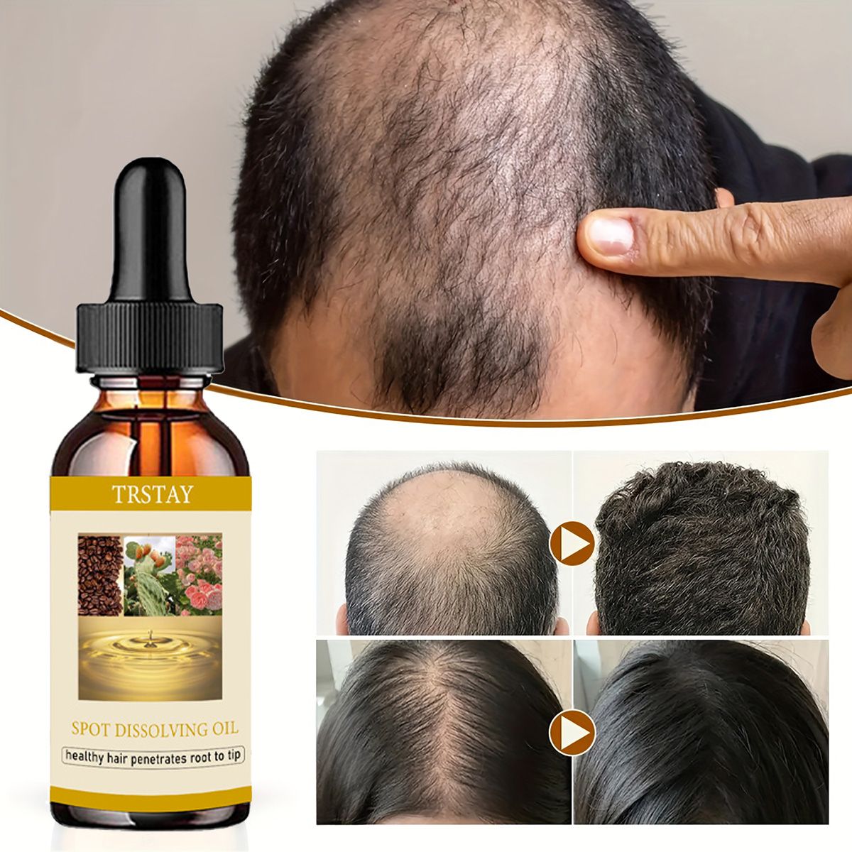 Beard Oil - 50 مللي نمو اللحية النفط مكافحة