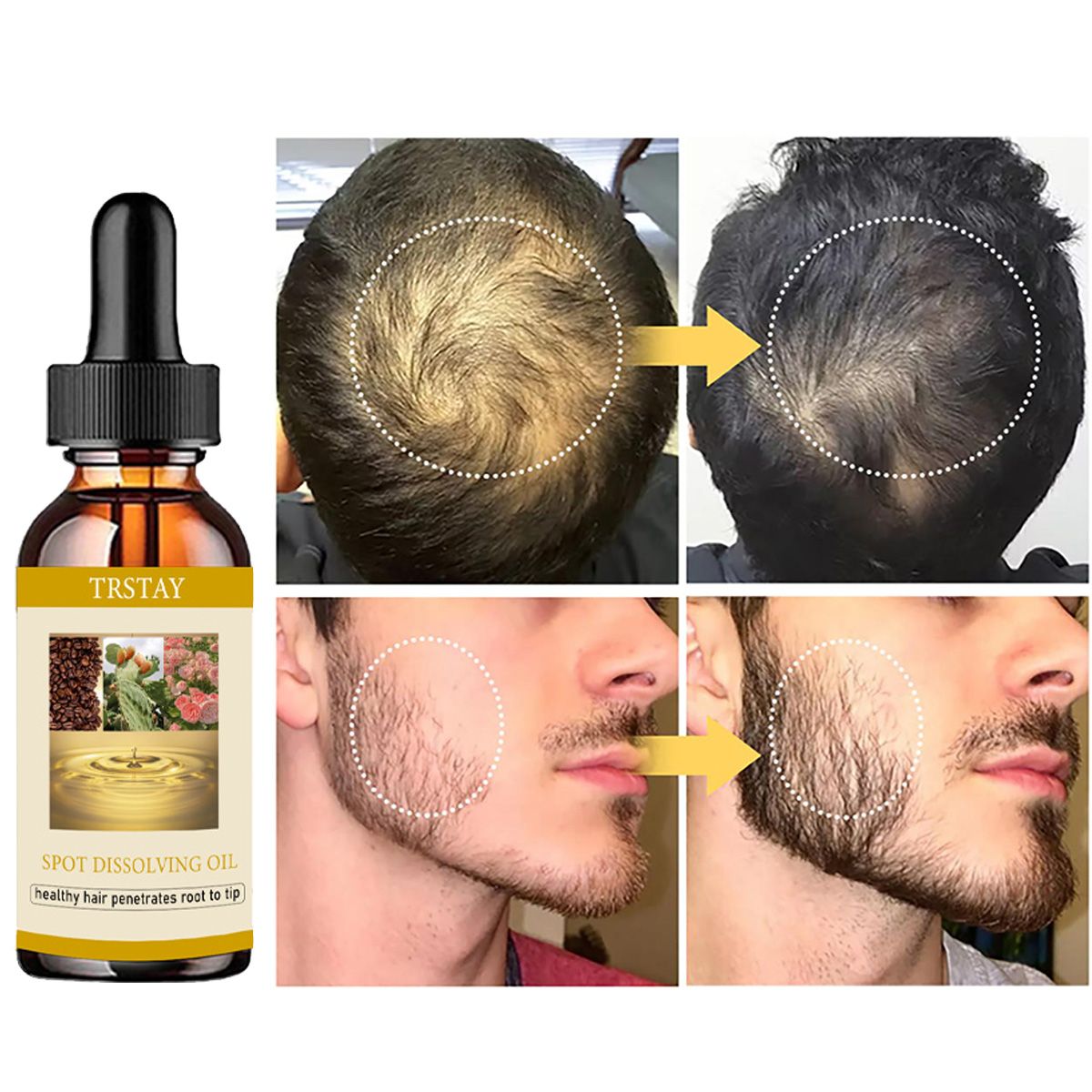 50 مللي نمو اللحية النفط مكافح - مراجعة Beard Oil وسعره