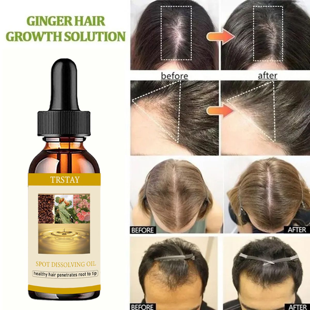 50 مللي نمو اللحية النفط مكافح - مراجعة Beard Oil وسعره